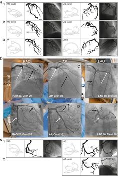 the different stages of an mri procedure are shown in black and white, with several images showing