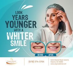 Teeth whitening is the fastest and easiest way to take a few years off your face and look younger. Set up your quick anti-aging teeth whitening treatment at http://www.smyrnadental.net/ #Teethwhitening #smyrna #GA #smyrnadental Dental Post, Dental Ads, Dental Advertising, Dental Social Media, Dental Bonding, Beauty Skin Quotes