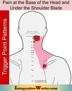 Pain at the Base of the Head and Under Shoulder Blade - Integrative Works Shoulder Pain Remedies, Neck And Shoulder Exercises