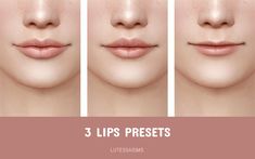 four different stages of lip fillers for the skin and lips, with text overlay