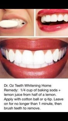 Baking Soda Lemon Juice, Baking Soda And Lemon, Best Teeth Whitening, Natural Teeth Whitening, Natural Teeth