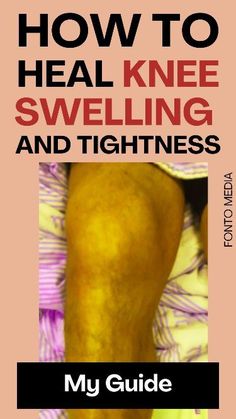 Knee Swelling, Swelling Remedies