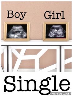 an x - ray is shown with the words boy and girl in front of it