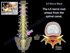 Anatomy Notes, Sciatic Nerve Pain, Nerve Damage, Sciatic Nerve, Back Pain Exercises, Post Op