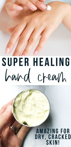 The BEST moisturizing hand cream for dry, cracked, overwashed hands. A must make in the winter! Diy Body Cream, Aloe Vera Gel For Hair Growth, Moisturizing Hand Cream, Diy Body Butter, Diy Cream