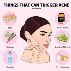 Beginner Skin Care Routine, Face Mapping Acne, Skin Advice, Basic Skin Care Routine, Clear Skin Tips, Face Acne, Facial Skin Care Routine, Skin Care Remedies