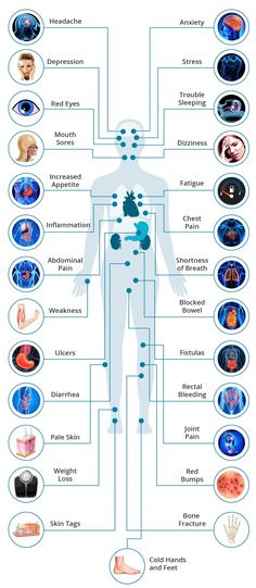 Crohn’s disease is an autoimmune disorder that causes problems in the digestive tract and other areas of the body. Digestive Tract, Autoimmune Disorder