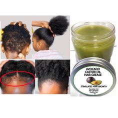 Hair Growth Grease, Oils Benefits, Hair Grease, Rosemary Hair Growth, Black Hair Growth, Rapid Hair Growth, Castor Oil For Hair Growth, Dunner Wordend Haar, Avocado Hair