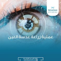 عملية زراعة عدسة العين في تركيا هي إجراء يهدف لاستبدال العدسة الشفافة داخل العين بعدسة اصطناعية ذكية تصحح مشاكل الرؤية وضعف النظر، لنتعرف على عملية زرع العدسات.