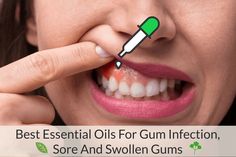 Clove Oil, Receding Gums