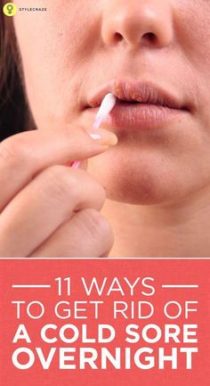 Cold sores are painful and embarrassing. Click here to learn about how to get rid of cold sores, including their causes, home remedies, and prevention tips. Diy Remedies, Cold Remedies, Lose 40 Pounds