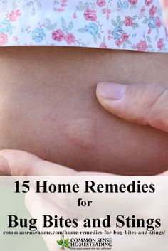 15 Home Remedies for Bug Bites and Stings - Ditch the itch from mosquito bites and more with these easy to use bite treatments. Natural Bug Bite Remedy, Remedies For Bug Bites, Bug Bite Itch, Remedies For Mosquito Bites, Bug Bites Remedies, Bug Bite Relief, Bite Relief, Bed Bug Bites