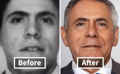 before and after photos of a man's face