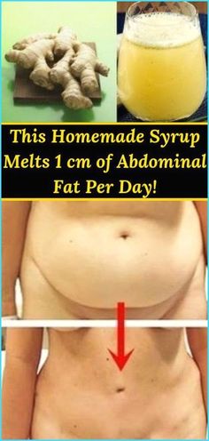 Homemade Syrup, Medicine Book, Abdominal Fat, Water Retention, Natural Medicine, Herbal Medicine, Diet Tips, Lose Belly, Natural Healing