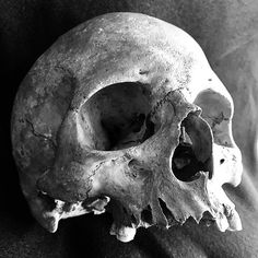 a black and white photo of a human skull