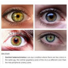 Eye Color Facts, Central Heterochromia, Heterochromia Eyes, Different Types Of Eyes, Eye Facts, Types Of Eyes, Crazy Eyes, Daily Writing, Amazing Pictures