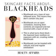 When it comes to pimples, you might think that they’re all pretty much the same…right? Any breakout is just a breakout, isn't it? Well, when it really comes down to the core of it, there are actually a lot of different types of breakouts out there - and knowing the difference between them is critical when it comes to t What Are Blackheads, Skincare Facts, Clear Blackheads, Skin Facts, Prevent Pimples, Skin Advice