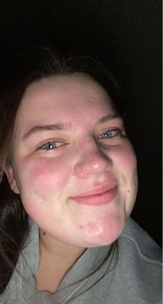 a woman with freckles on her face smiling at the camera while she is taking a selfie