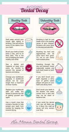 Tips For Teeth, Dental Health Care, Dental Cavities, Nutrition Sportive, Teeth Health, Oral Care Routine, Dental Surgery, Dental Problems