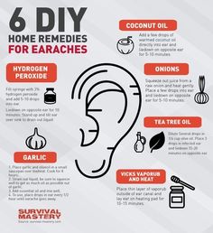 Earache Remedies, Ear Ache, Natural Healing Remedies, Ear Care, Diy Remedies, Ear Wax, Cold Remedies, Natural Therapy, Natural Health Remedies