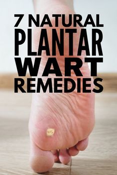 essential oils for dental care Planter Warts Remedies, Plantar Wart Remedies, Home Remedies For Congestion, Planters Wart, Plantar Warts, Home Remedies For Warts, Warts Remedy, Home Remedy For Cough, Cold Sores Remedies