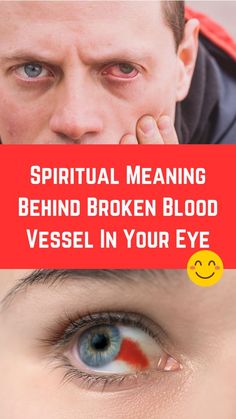 Spiritual Meaning Behind Broken Blood Vessel In Your Eye (Facts) Blood Vessel In Eye, Eye Facts, Eye Meaning, Deeper Meaning, Outdoor Cat, Clear Eyes