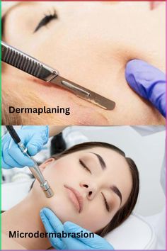 Dermaplaning vs. Microdermabrasion: A Battle of Beauty Techniques! Discover the key differences and benefits of these popular exfoliation treatments, and find out which one reigns supreme for achieving radiant skin. #BeHacks #BeautyTreatments #BeautyTips #BeautyHacks #Dermaplaning #Microdermabrasion #DermaplaningVsMicrodermabrasion #SkincareComparison #ExfoliationBattle #SkinRenewal #GlowingSkin #DermaplaningBenefits #MicrodermabrasionBenefits #SkincareDebate #BeautyTechniques #RadiantComplexion Microdermabrasion Before And After, Dermaplaning Aesthetic, Dermaplaning Before And After, Dermaplaning At Home, Microdermabrasion Benefits, Wedding Skincare, Laser Facial, Flawless Skin, Skin Rejuvenation