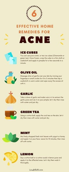 Remedies For Acne, Acne Overnight, Skin Care Routine For 20s, Natural Acne, Home Remedies For Acne, Acne Problem, Acne Remedies, Skin Remedies