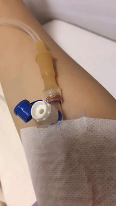 Iv Drip In Arm Snapchat, Indian Hospital Snapchat Stories Hand, Dextrose In Hand Hospital Girl, Cannula Hand Pic, Tablet Medicine Snap, Medicine Snaps