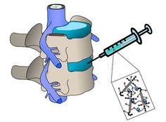 Neck Traction, Spine Health, Biomedical Engineering, Cell Therapy, Joints Pain Relief, Popular Science, Nanotechnology, Scientists, Science And Technology