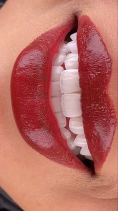 Teeth Makeover, Naturally Whiten Teeth, Smile Tips, Cosmetic Dentistry Veneers, Cosmetic Dentistry Procedures, Hollywood Smile, Dental Videos