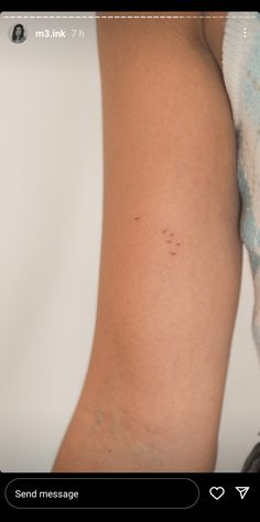 a woman's arm with small black dots on the back of her leg and it is