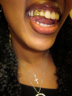 Star Grillz Gold, Girly Grillz Gold Grill, 2 Teeth Grillz, Grill Design Teeth, Cute Grills For Women, Cute Grills, Grillz For Females, Gold Chain Aesthetic