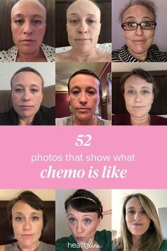 52 Photos Capture This Woman’s Triumph Over Breast Cancer #healthline #pawsitively4pink #breastcancer #triumph Herbs For Hair, Brown Spots On Face, Essential Oils For Hair, Hair Prom, Hair Braids, Braids Hairstyles, Get A Tattoo