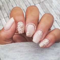 Dip Nails, Rose Gold Nails, Gold Nail, Cute Gel Nails, Her Nails, Dipped Nails, Nails Toes, Fancy Nails