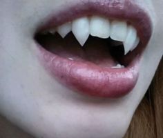 a woman's mouth with white teeth and red hair