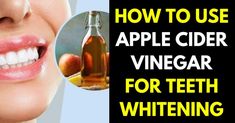 Using Apple Cider Vinegar for Teeth Whitening? (Benefits, Tips & Precautions) 5 Whiten Teeth At Home, Baking Soda Teeth Whitening, Baking Soda Toothpaste, Teeth Whitening Methods, Mouth Care, Dogs Teeth, Teeth Whitening Homemade, Heal Cavities, Tooth Whitening