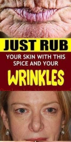 Wrinkles Remedies Face, Homemade Wrinkle Cream, Get Rid Of Wrinkles, Wrinkle Remedies, Wrinkle Free Skin, Facial Wrinkles, Skin Care Wrinkles, Glow Skin, Face Wrinkles