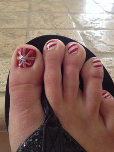 Christmas toes! Festive Pedicure, Nails Design For Christmas, Pedicure Christmas Designs, Mistle Toe Nail Design, Christmas Pedicure Ideas Toes, Christmas Tree Toe Nail Designs, Red And White Christmas Toe Nails, Christmas Toenails, Christmas Toe Nail Designs