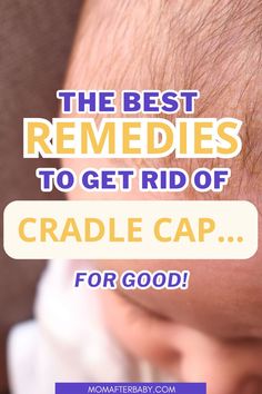 Struggling with baby cradle cap? I've got you covered with cradle cap remedies that are gentle yet effective! From newborn basics to a natural cradle cap remedy, these tips show you how to get rid of cradle cap safely. Say goodbye to baby dandruff with these tried-and-true baby remedies! Baby Dandruff, Newborn Basics, Cradle Cap Remedies, Baby Cradle Cap, Dry Scaly Skin, Baby Remedies, Cradle Cap, Scaly Skin, Baby Cradle