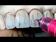 Tooth Morphology, Dentist Cartoon, Dental Hygiene School, Veneers Teeth, Dental Surgeon