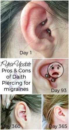 Piercing Healing, Headache Relief Instant, Migraine Pain