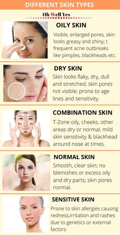 How to Know Your Skin Type to Care Better - Oh Well Yes Haut Routine, Dry Skin On Face, Types Of Skin, Skin Allergies, Body Scrubs, Dry Skin Care