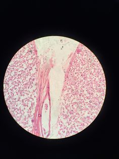 an image of the inside of someone's stomach, with pink and white markings