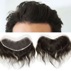 This mens frontal hairpiece is specifically designed for people who have hair loss only at the front hairline, which is also commonly called a receding hairline, and still have healthy hair elsewhere on the head. Men Hairline, 90 Hair, Hair Pieces For Men, Alopecia Hairstyles, Human Hair Pieces, Mens Toupee, Receding Hairline, Indian Human Hair, Natural Human Hair