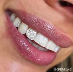 Piercing No Dente, Tooth Piercing, Heart Tooth Gem, Teeth Accessories, Teeth Charms, Tooth Jewellery, Tooth Outline, Jewelry Teeth, Pretty Teeth