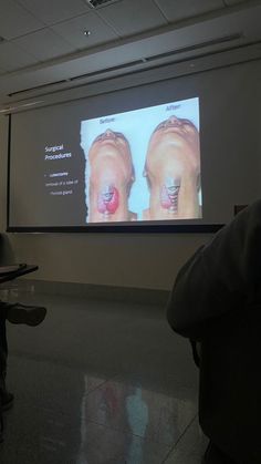 two people sitting in front of a projector screen with an x - ray image on it