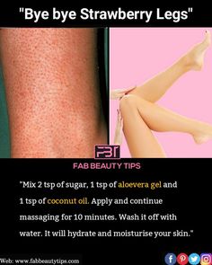 #strawberrylegs #moisturecream #moistureskin #hydrateskin #beautytips #fabbeautytips Dark Inner Thighs, Beginner Skin Care Routine, Multani Mitti, Strawberry Legs, Face Skin Care Routine, Clear Healthy Skin, Natural Skin Care Remedies, Diy Skin Care Routine, Natural Face Skin Care