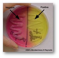 a person is holding a petri dish with two sections labeled asm and negative