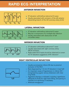 the different types of electronic interfaces